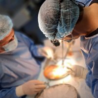 Група хірургів проводить операцію з трансплантації серця