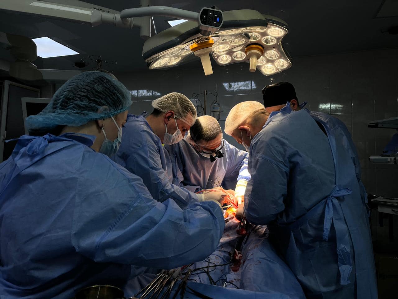 лікарі під час трансплантації нирки